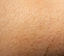Best Skincare for Dry Skin