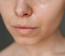 Skincare Tips for Oily and Acne-Prone Skin
