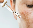 Tranexamic Acid for Stubborn Hyperpigmentation