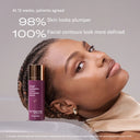 Woman with a Skinbetter Ampra  Volume HA Serum product bottle, showing skin improvement statistics.