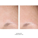 SkinBetter AlphaRet® Overnight Cream