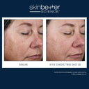 Before-and-after clinical comparison of a woman's face showing improvement in skin texture and spots using skinbetter alto defense repair serum 