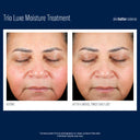 SkinBetter Trio Luxe Moisture Treatment