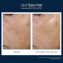 SkinBetter Trio™ Rebalancing Moisture Treatment