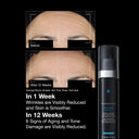 skinceuticals-advanced-rgn-6-before-after