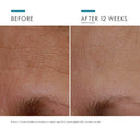 Before and after comparison of skin texture improvement after 12 weeks, showing a clear improvement from using skinceuticals age interrupter