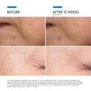 skinceuticals-ptiox-before-after-2